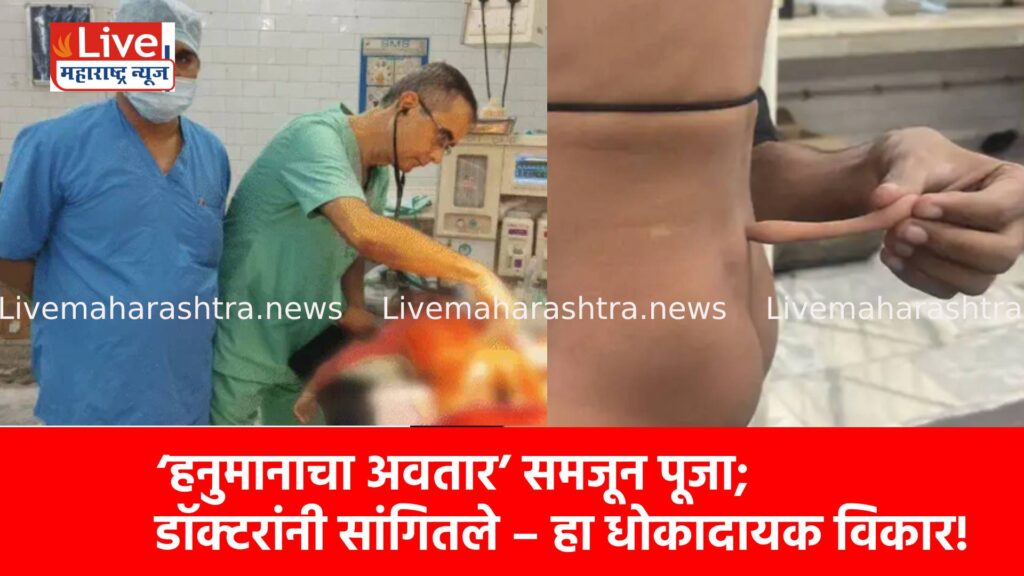 ‘हनुमानाचा अवतार’ समजून पूजा; डॉक्टरांनी सांगितले – हा धोकादायक विकार!